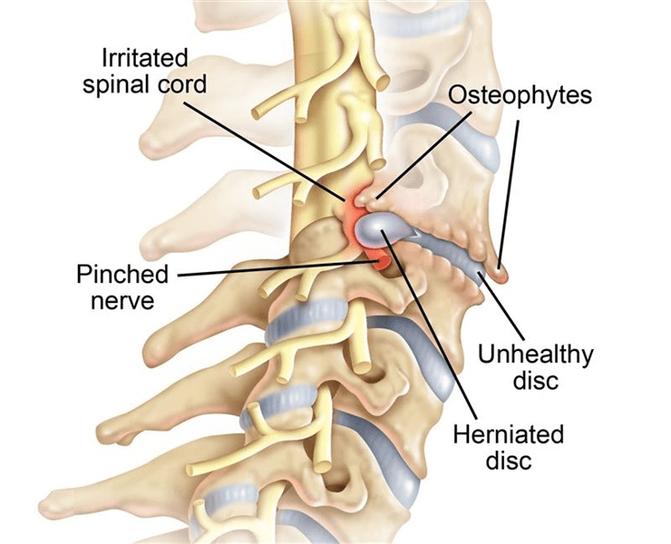 Spinal Cord and Vertebra